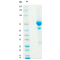 Anti-Human CD52 mAb