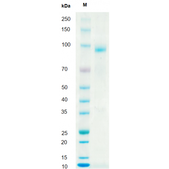 Recombinant Human HGF Protein