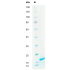 Recombinant Human PDGF-BB Protein