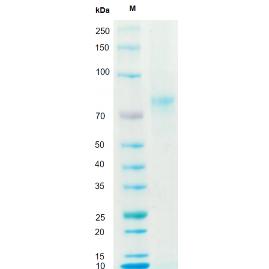 Recombinant Human Vitronectin Protein